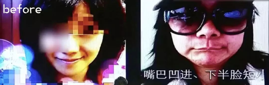 韩整容失败的中国女孩10.jpeg