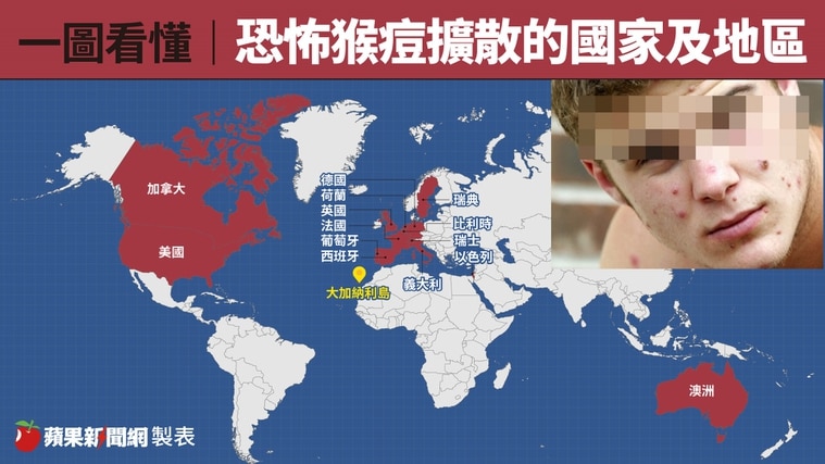 猴痘的扩散国家及地区地图